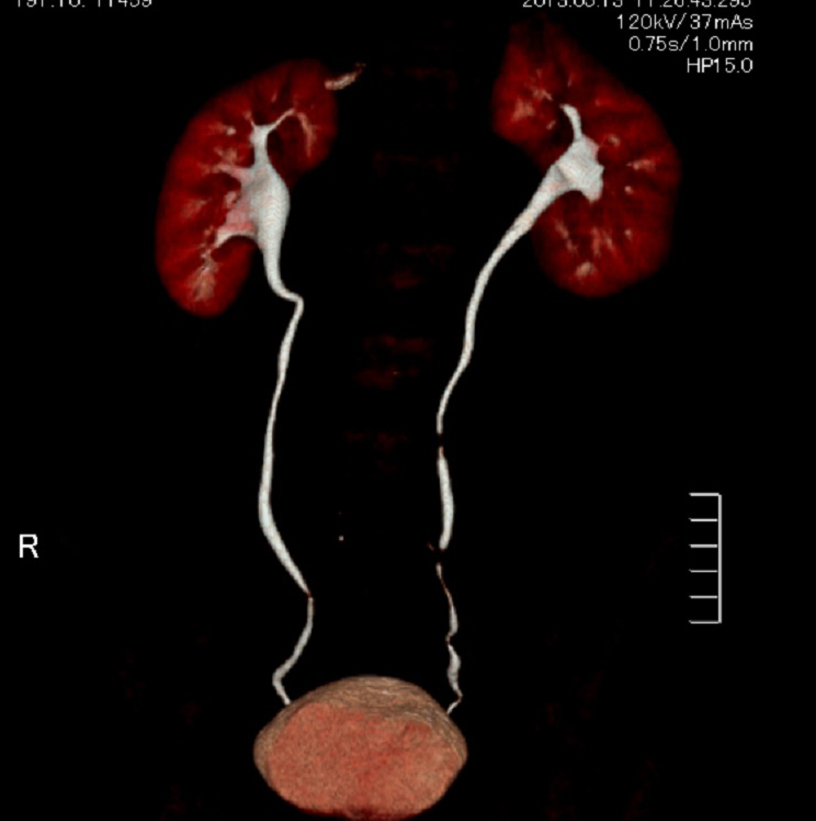 尿管・腎臓・膀胱
